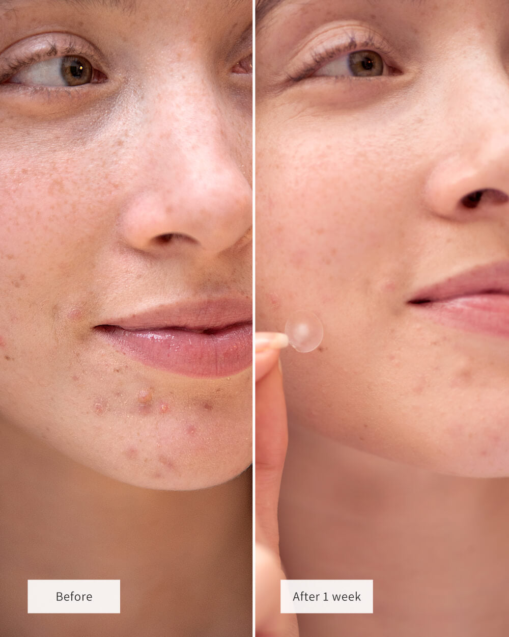 CLEARING SPOT PATCHES